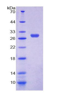 Recombinant Thyroid Hormone Receptor Beta (THRb)