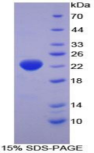 RPA871Hu01.jpg