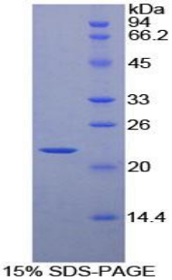 Recombinant Heat Shock Protein Beta 2 (HSPb2)