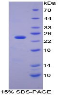 Recombinant Carbonic Anhydrase I (CA1)