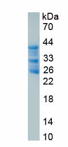 Recombinant Neuropeptide Y (NPY)