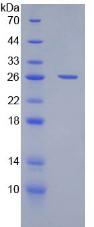 Recombinant Cluster Of Differentiation 200 (CD200)