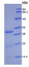 Recombinant Cluster Of Differentiation 26 (CD26)