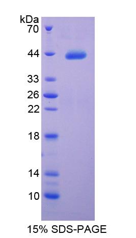 Recombinant Complement Component 4 (C4)