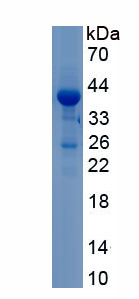 Recombinant Complement Component 4 (C4)