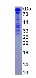 Recombinant Osteopontin (OPN)