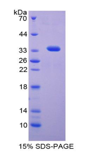 Recombinant Osteopontin (OPN)