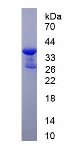 Recombinant Dopamine Receptor D3 (DRD3)