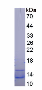 Recombinant Chemokine C-C-Motif Receptor 5 (CCR5)