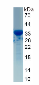 Recombinant Tumor Protein p53 (P53)