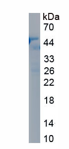 Recombinant Tumor Protein p53 (P53)