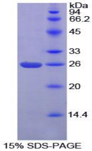 Recombinant Protein Interacting With C Kinase 1 (PICK1)