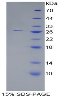 Recombinant Nephrin (NPHN)