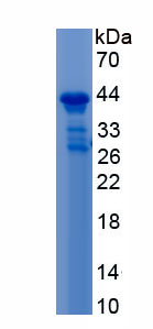 Recombinant Nephrin (NPHN)