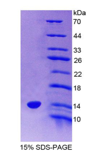 Recombinant Pre-B-Lymphocyte Gene 1 (VPREB1)