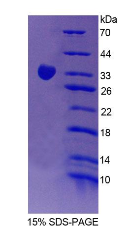 RPA947Hu01.jpg