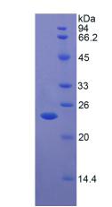 Recombinant Thymidine Phosphorylase (TP)