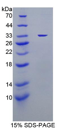 Recombinant Thymidine Phosphorylase (TP)