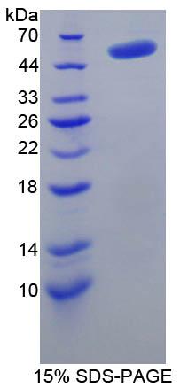 Recombinant Thymidine Phosphorylase (TP)