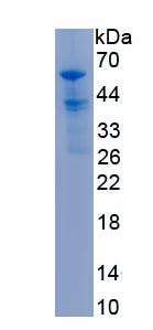 Recombinant Von Willebrand Factor Cleaving Protease (vWFCP)