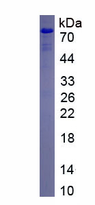 Recombinant Von Willebrand Factor Cleaving Protease (vWFCP)