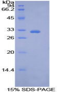 Recombinant Pyruvate Dehydrogenase Kinase 4 (PDK4)