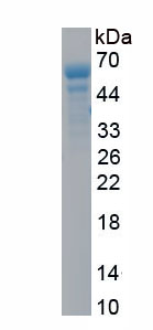 Recombinant Glypican 3 (GPC3)