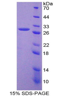 Recombinant Glypican 3 (GPC3)