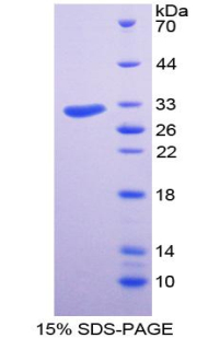 Recombinant Discoidin Domain Containing Receptor 2 (DDR2)