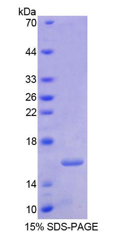 Recombinant Retinoic Acid Receptor Alpha (RARa)