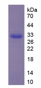 RPA981Hu01.jpg