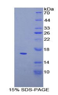 Recombinant Cluster Of Differentiation 160 (C<b>D160</b>)