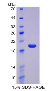 Recombinant Cluster Of Differentiation 160 (C<b>D160</b>)