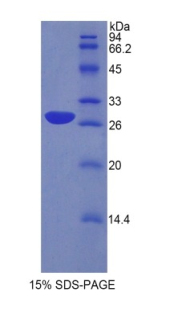 Recombinant Protein Zero, Myelin (MPZ)