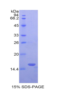 Recombinant Leukocyte Associated Immunoglobulin Like Receptor 2 (LAIR2)