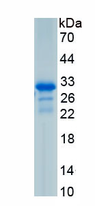 Recombinant Cluster Of Differentiation 320 (CD320)