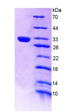 Recombinant Low Density Lipoprotein Receptor (LDLR)