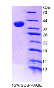 Recombinant Very Low Density Lipoprotein Receptor (VLDLR)