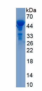 Recombinant Alpha-1-Antichymotrypsin (a1ACT)