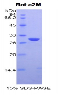 Recombinant Alpha-2-Macroglobulin (a2M)