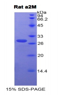 Recombinant Alpha-2-Macroglobulin (a2M)