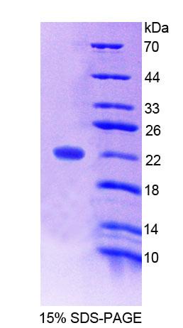 Recombinant Angiopoietin Like Protein 4 (ANGPTL4)