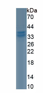 Recombinant Protein Tyrosine Phosphatase Receptor Type C (CD45)