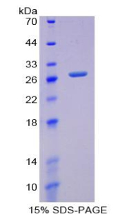 Recombinant Glutamate Cysteine Ligase, Modifier Subunit (GCLM)