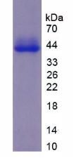 Recombinant Vitronectin (VTN)