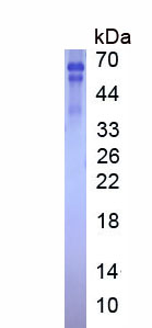 Recombinant Vitronectin (VTN)