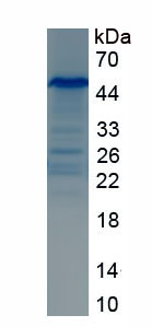 Recombinant Integrin Beta 1 (ITGb1)