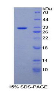 Recombinant Protein Tyrosine Phosphatase Receptor Type B (PTPRB)