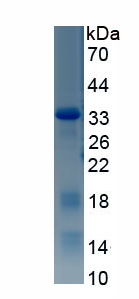 Recombinant Estrogen Receptor Alpha (ERa)