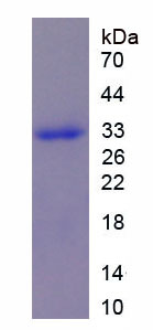 Recombinant Estrogen Receptor Alpha (ERa)